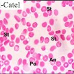 Blood Smear (exposed for 45 min/day)