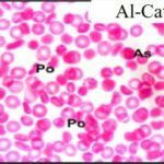 Blood Smear (exposed for 30 min/day)