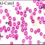 Blood Smear (exposed for 60 min/day)